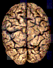   | Brain | 